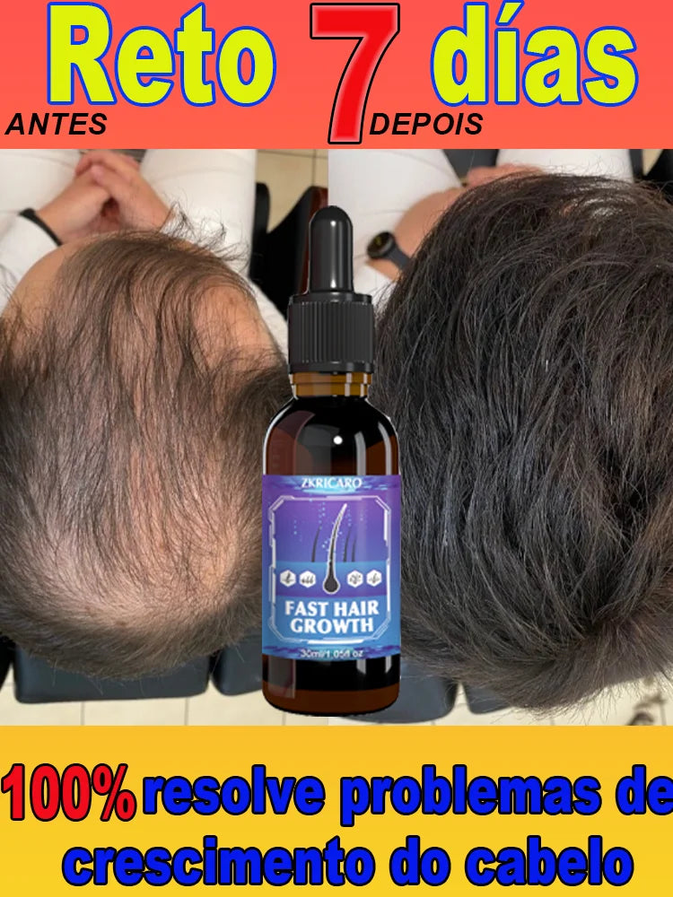 Essential oil promotes rapid hair growth and treats baldness and hair loss